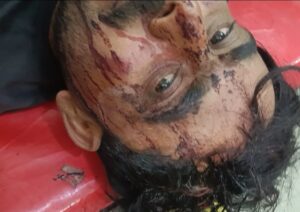 दुगरैय्या में ट्राली में आलू भरकर ले जा रहे युवक पर कुल्हाड़ी से हमला युवक गंभीर रुप से घायल रास्ते में खड़ी थी भूसा भरी ट्राली वाहन निकालने को लेकर हुआ था झगड़ा